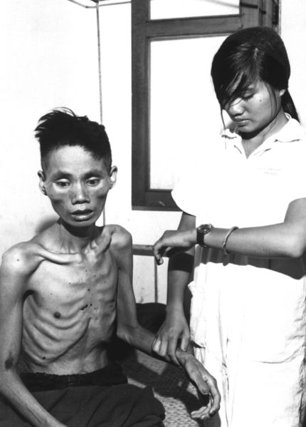 430px-starved_vietnamese_man_1966